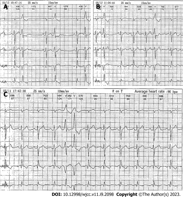 Anesthetic Management Of A Patient With Preoperative R on T Phenomenon funny-coffee-memes-for-caffeine-addicts-coffee-meme-coffee-humor