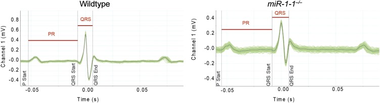 Figure 1—figure supplement 4.