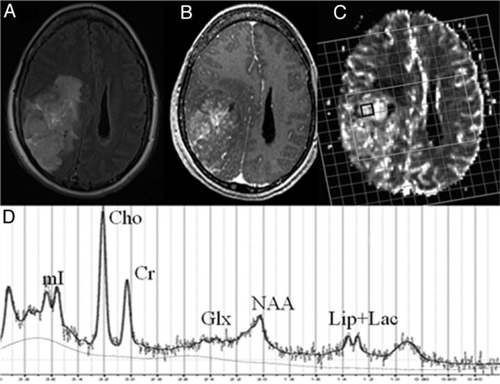 Fig 1.