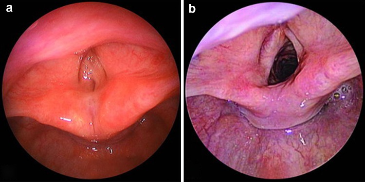 Fig. 6