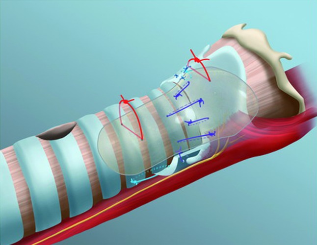 Fig. 3