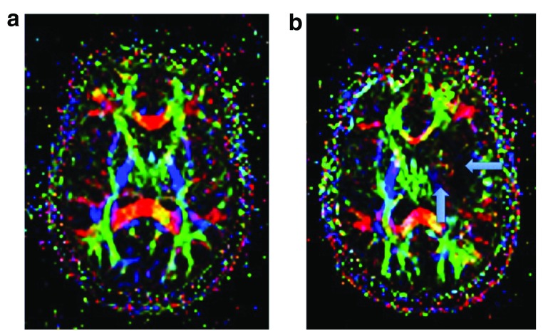 Figure 3a–b. 