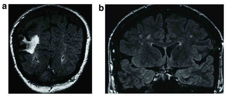 Figure 1a–b. 