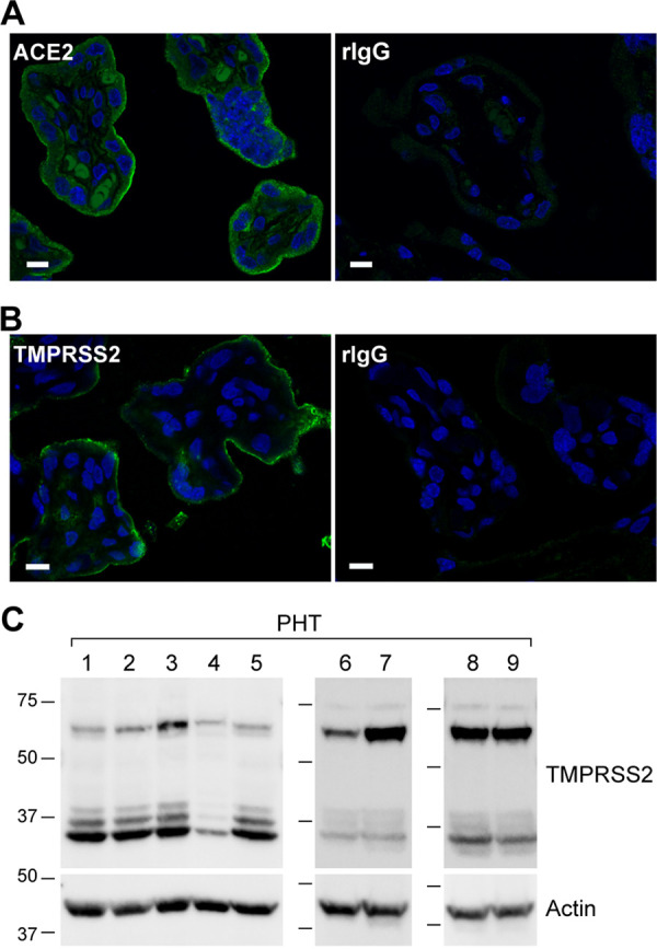 FIG 3