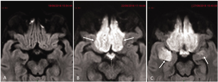 Fig. 2.