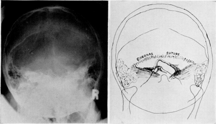 Fig. 2 a-b