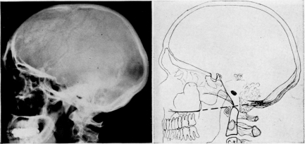 Fig. 1 c-d