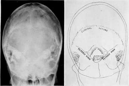 Fig. 2 c-d