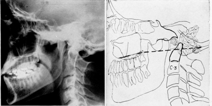 Fig. 1 a-b