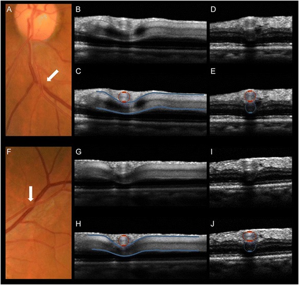 Fig. 4