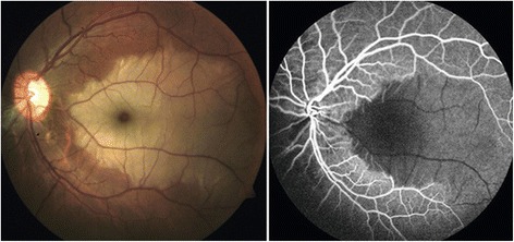 Fig. 14