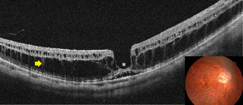 Figure 11.