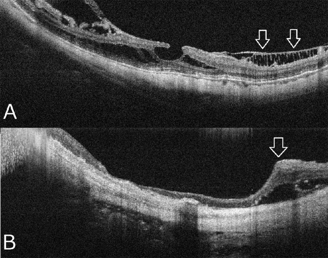 Figure 12.