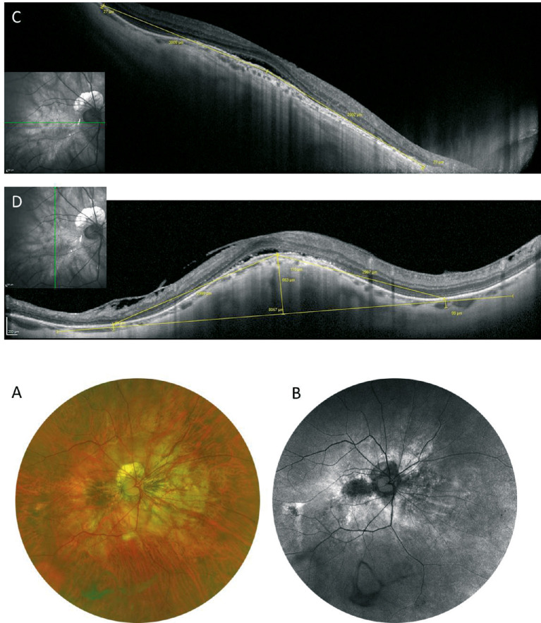 Figure 18.