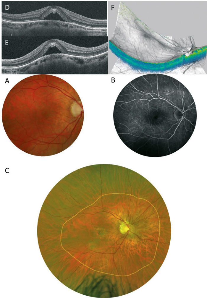 Figure 15.