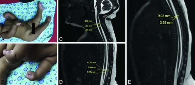 Fig 2.