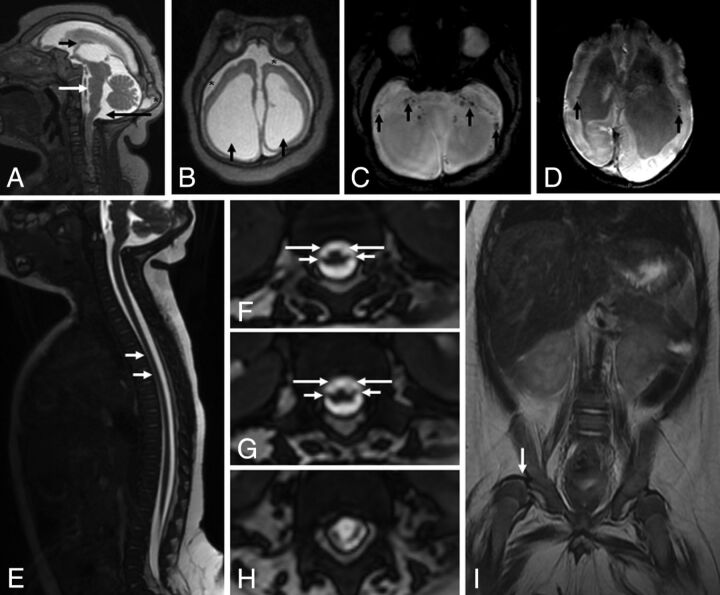 Fig 3.