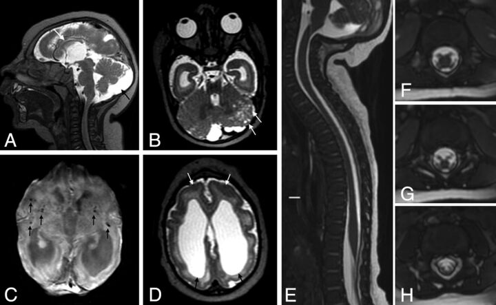 Fig 5.