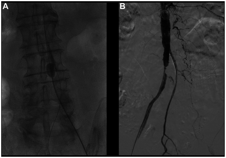 Fig 2