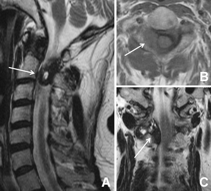 Fig. 1