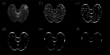 Fig. 15