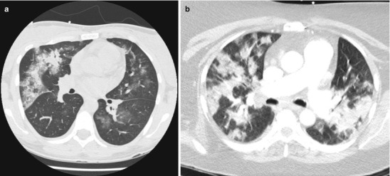 Fig. 10.5