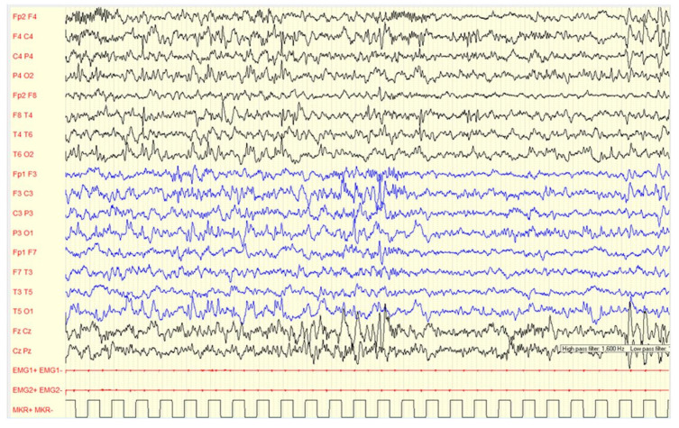 Figure 5