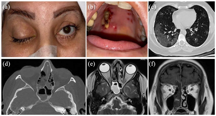 Figure 1.