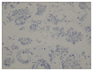 Figure 1B