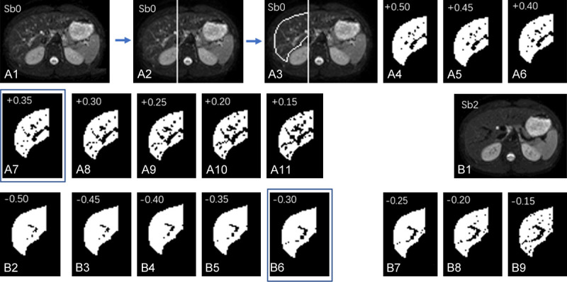 Figure 14