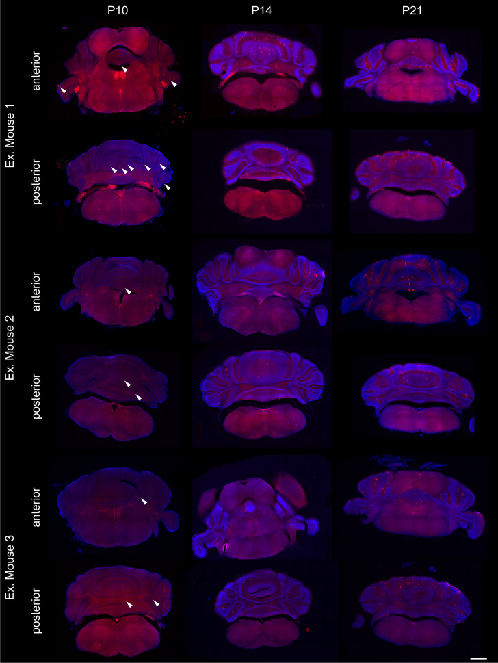 Figure 5—figure supplement 1.