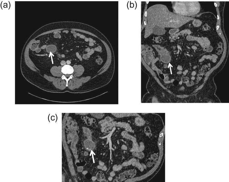 Figure 2: