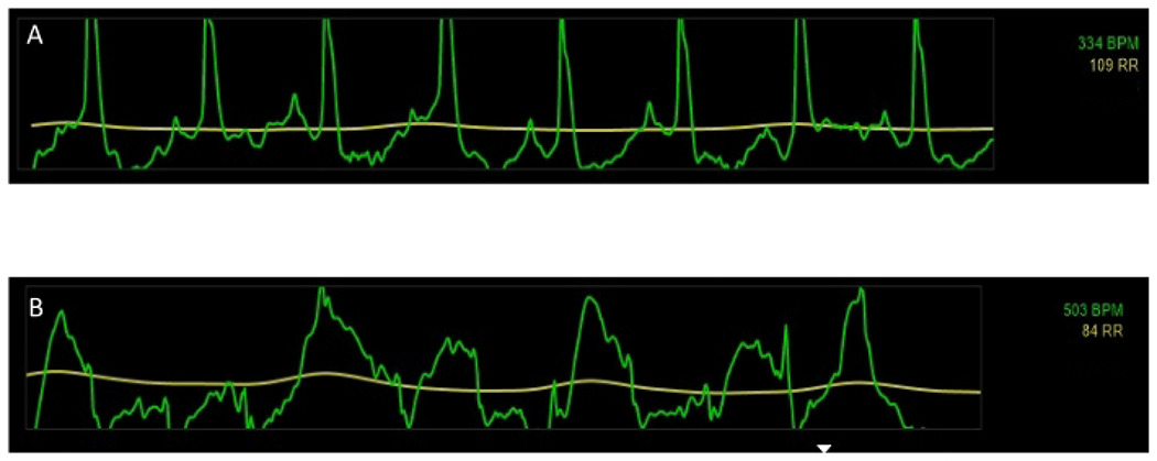 Figure 1: