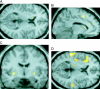 Figure  3