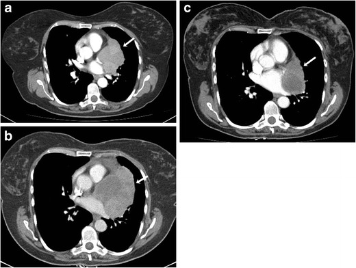 Fig. 10