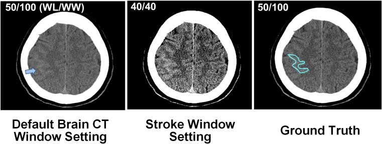 Fig. 3