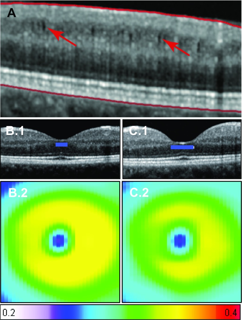 Fig. 3