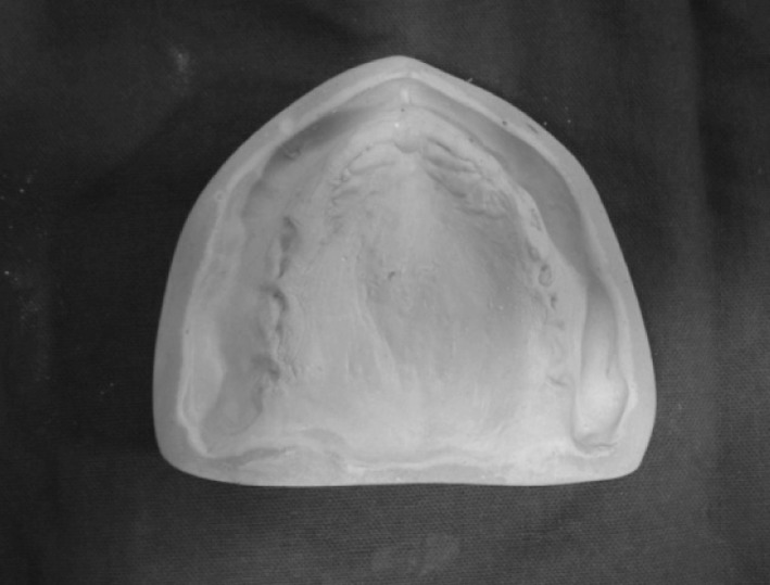Fig. 11