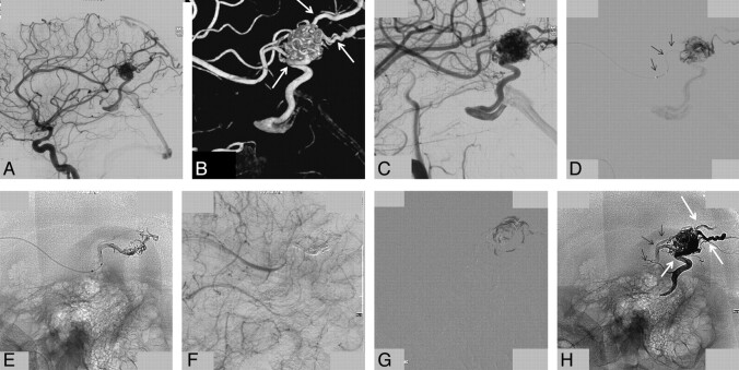 Fig 4.