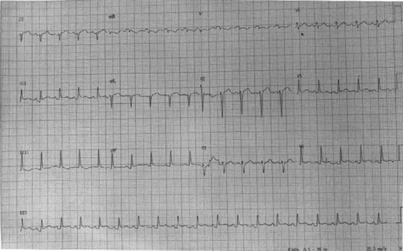 Figure 1: