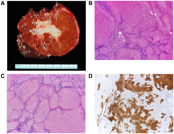 FIG 2