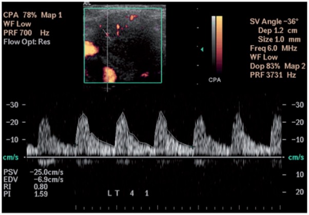 Figure 11