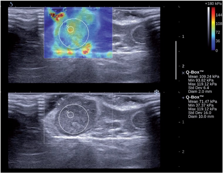 Figure 15