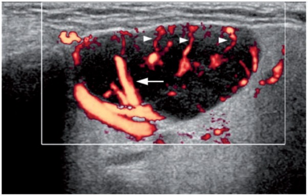 Figure 10