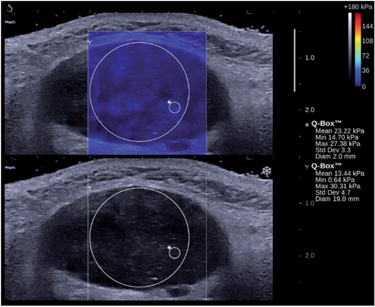 Figure 14