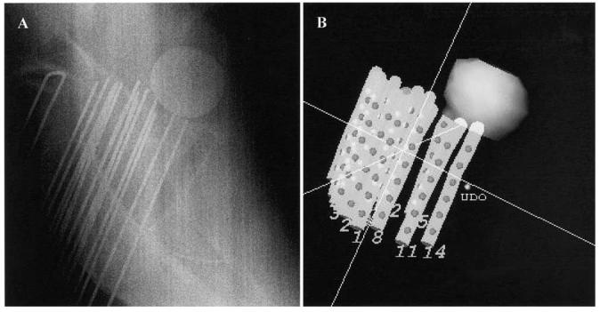 Fig. 3