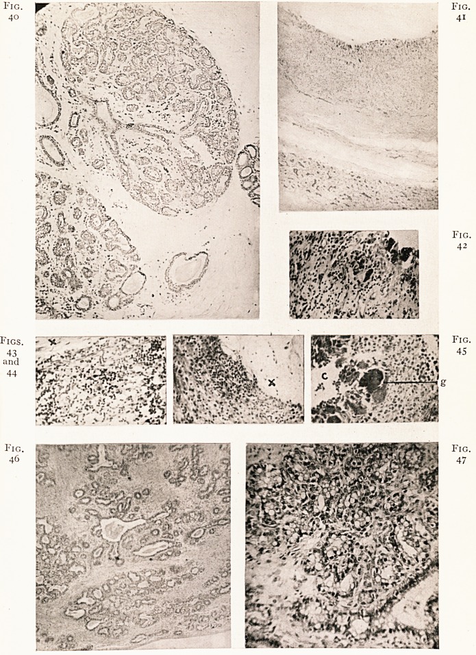 Fig. 40 Fig. 41 Fig. 42 Figs. 43 and 44 Fig. 45. Fig. 46 Fig. 47