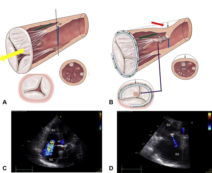 Figure 3