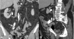 Fig. 12
