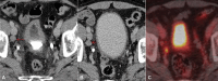 Fig. 11